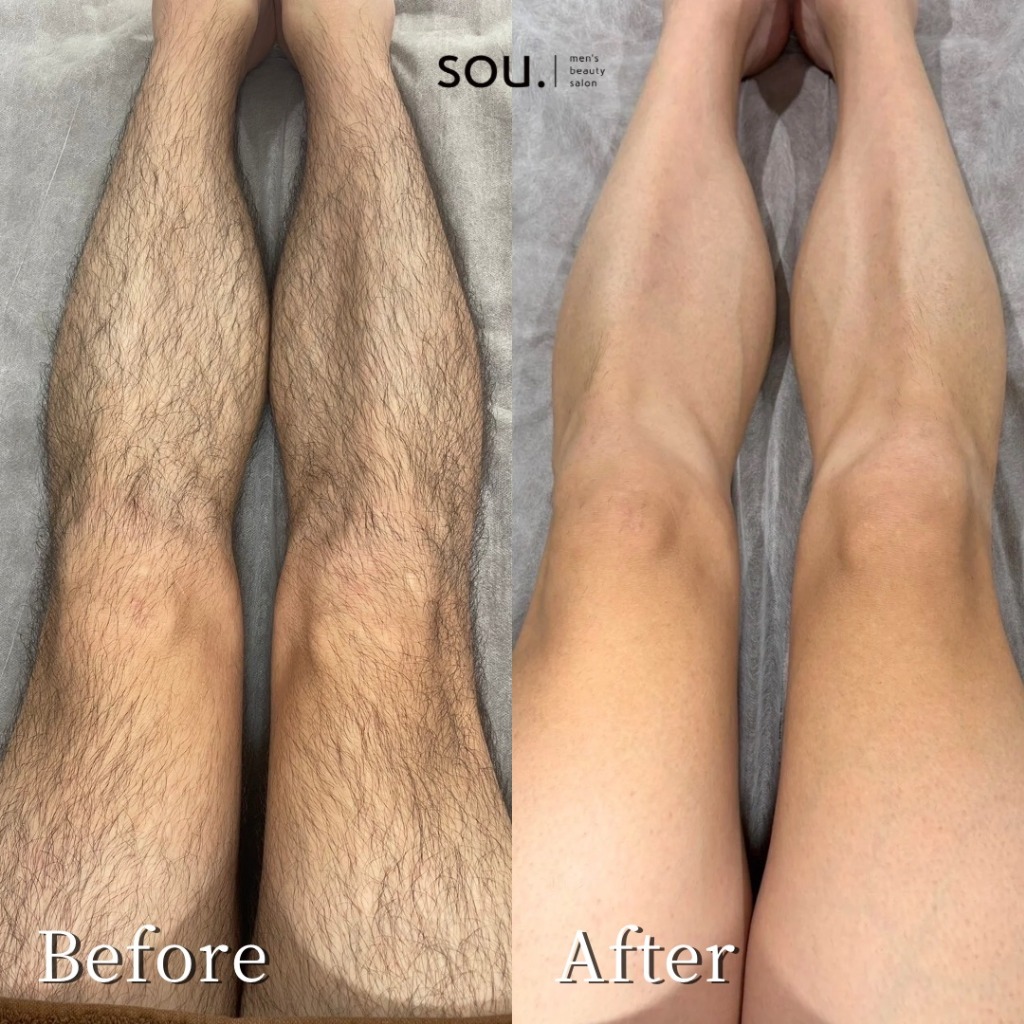 「足の毛って、こんなに印象を左右するんですね！」