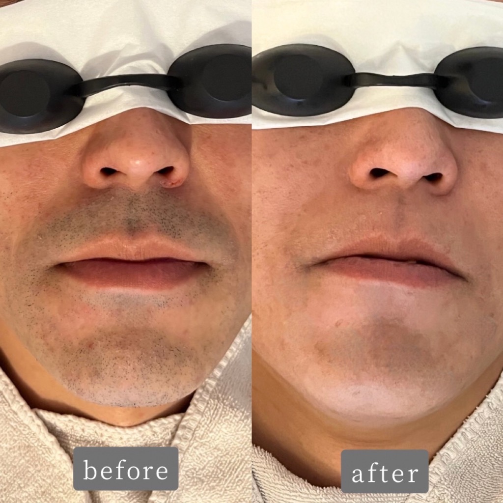 めんどくさいあの習慣なくせます！