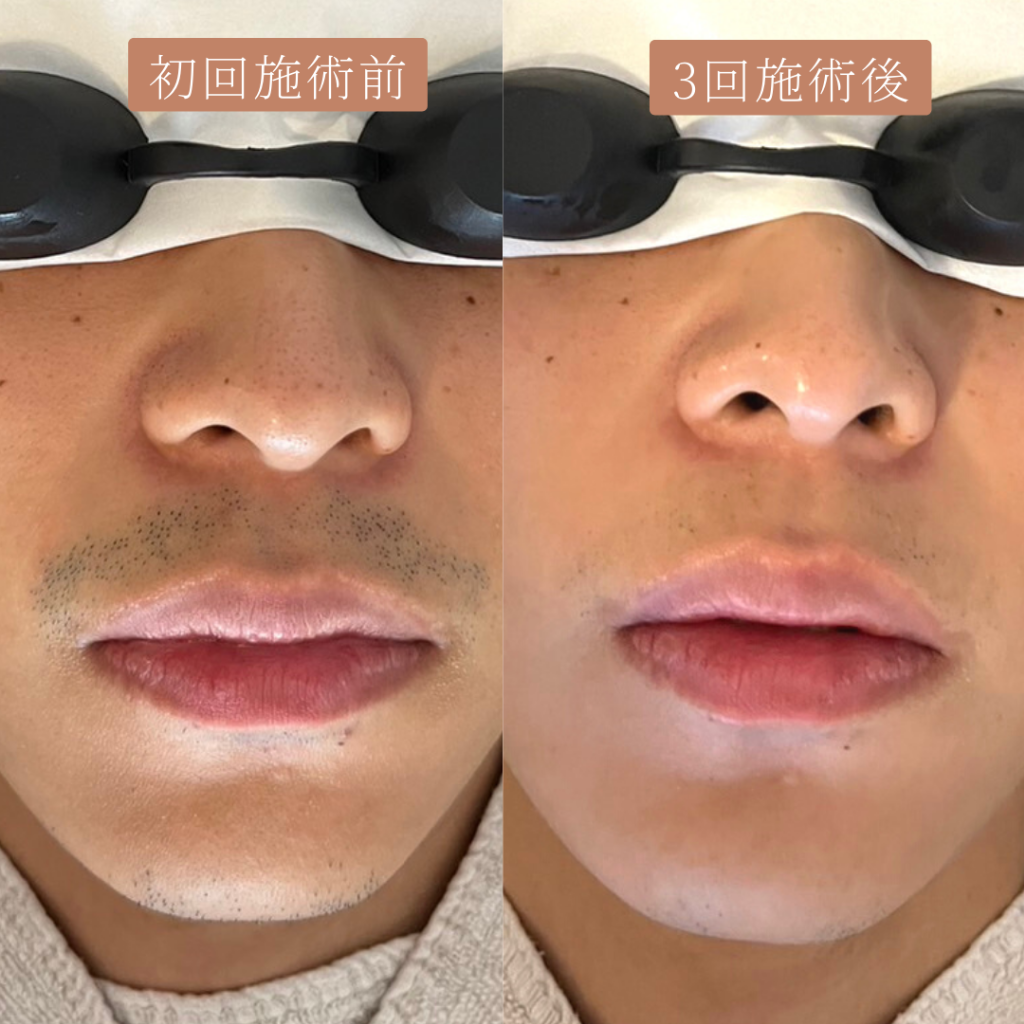 たった３回で、、！